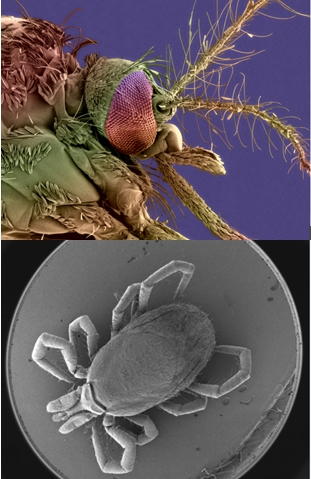 Découverte des Pathogènes en microscopie électronique à balayage